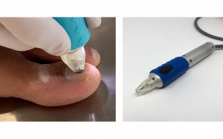 FDA-Cleared Medical Device Platform with Patented Technology