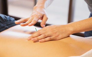Acupuncture Practice for Sale